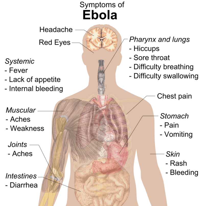 Symptoms_of_ebola